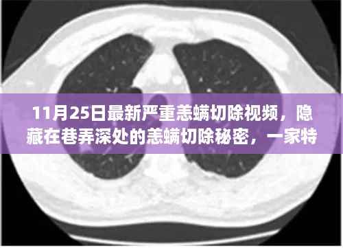 巷弄深处的恙螨切除秘密,特色小店非凡之旅最新视频