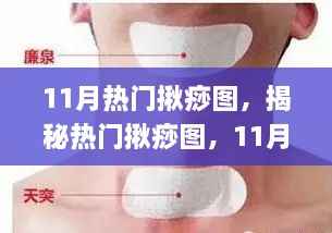 揭秘揪痧流行,11月揪痧图趋势与应对指南
